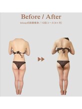 ビループ(biloop)/4ヶ月あれば別人bodyになれる。