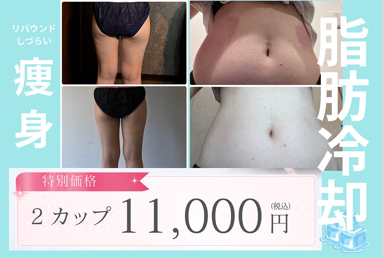 高周波痩身美容器■寝てるだけ簡単ダイエット■ビューティワールドお求めの方にも⑰ エノアシュエット(Enoachouette)｜ホットペッパービューティー