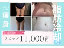 エノアシュエット(Enoachouette)