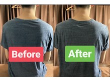 松 中目黒/【30代男性 肩こり猫背改善例】