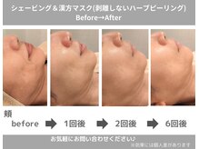 ももとゆでたまご/ハーブコースbefore→after