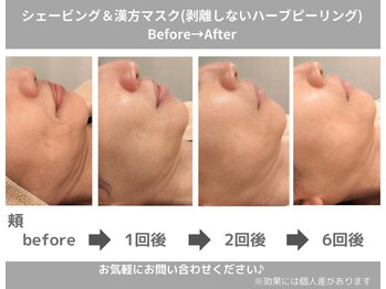 ももとゆでたまご/ハーブコースbefore→after