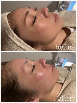 すっぴん美肌革命/お肌のハリ、ツヤアップ