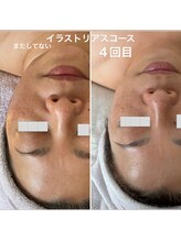 リュミエール(Lumie're)/イラストリアス