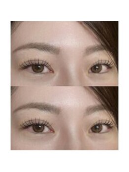 バニーアイズ 天神(Bunny eyes TENJIN)/フラット120本