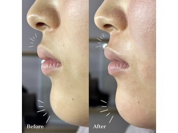 ホワイトワックス 浜松(WHITE WAX)/細かい部分もおまかせあれ