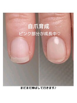 エルアンド(elle＆)/深爪育成　フィルイン