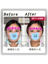 ルアナ(Luana)/最新ウルトラ小顔リフト