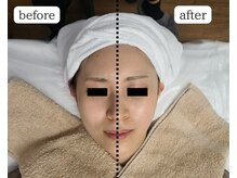 デサフィオ(Desafio)/before→after