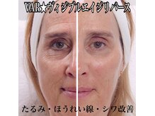 ラ セラフィータ 中目黒/VAR★ヴィジブルエイジリバース