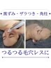【いちご鼻・黒ずみ改善】汚れもごっそり　90分　16500円　首リンパ付☆