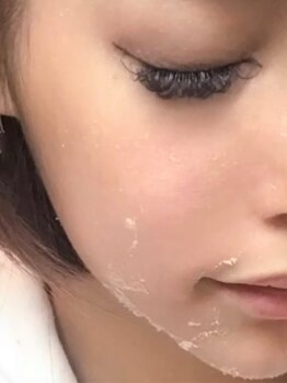 スリジエ ボーテ(cerisierBEAUTE)の写真/感動のリピ率95%超え!肌悩み全解決《Lv4ハ-ブピ-リング最大量¥34000》ハリ艶UPで透き通る様な陶肌体験を◎