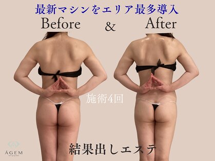 アージェム(AGEM)の写真