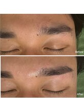 アミュレット(Amulette)/Before→After[1回の変化]まゆ毛