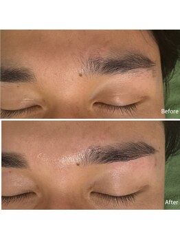 アミュレット(Amulette)/Before→After[1回の変化]まゆ毛