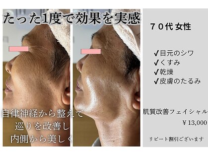 サロン ド ブラン(Salon de Blanc)の写真