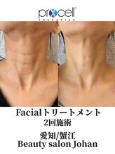 ジョアン(Johan)/プロセルでエイジングケア★