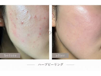 シイ(She)の写真