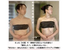蒼(so)の雰囲気（秋冬・12～3月婚の花嫁様多数。出ない鎖骨&肩甲骨はここで即解決）