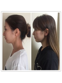 ラ アクサル(la.akthar)/小顔 全身 骨格矯正 整体