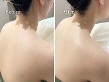 エリー(Ellie)/花嫁さんの肌に簡単になるには