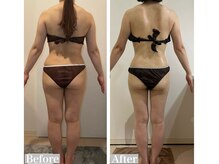 ヴィクシア(VIXIA)/痩身90分