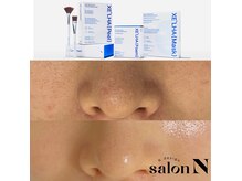サロンエヌ(salon N)の雰囲気(男性女性ともに肌質改善にセラピールをお試しください♪)