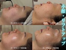 ハニエル(Haniel)の雰囲気（肌スコアUP・見た目を整えたい方必見☆驚愕の結果をお届け♪♪）