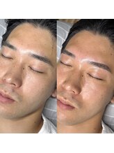 ジュビリー(JuBilee)/自己処理は控えてください◎