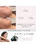 【たるみシワ元気のない肌に】フラクショナルRFで美しいフェイスライン¥7,800