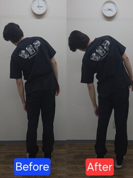 最後の整体 練馬駅前院/腰痛でお悩みの方の可動域