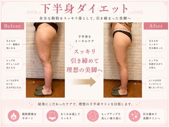 練馬アカデミア美容整体院/姿勢骨盤矯正ダイエット美容整体