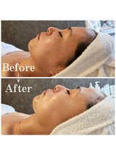 エメ(Aimer)/本来の美しい美白へ！