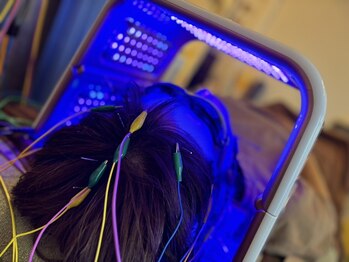 S鍼灸整骨院の写真/鍼による刺激で、血流を良くし老廃物の排出を促進◎お肌の悩みを改善し、キメの整ったお顔へ導きます！