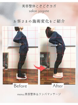 ヨギート(yogate)/整体/小顔/リンパマッサージ