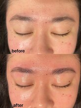 パピヨン(papillon)/ハリウッドブロウリフト【HBL】