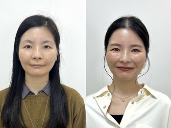 ウル 新宿代々木店(ULU)/自己診断はあっていたけど。。。