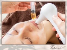 トーティシェル(tortoise shell)/縦ジワ、くすみにオススメ