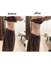 ジョワイユ(Joyeux)/腸の位置でお腹は変わる