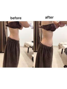 ジョワイユ(Joyeux)/腸の位置でお腹は変わる