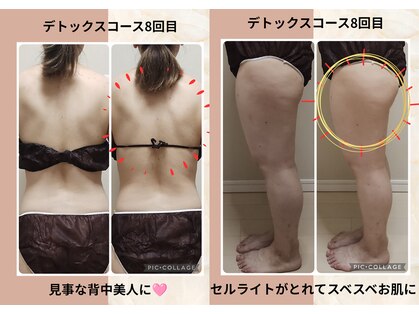 ヨサパーク ミミ 高野店(YOSA PARK mimi)の写真