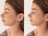 《　FACIAL　》鼻特化！鼻フル・鼻修正・鼻中隔・鼻尖形成等◎60分¥12,800