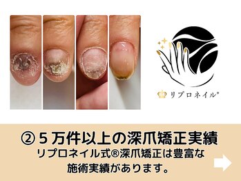 ブルームーンネイルズ(BLOOMOON.nails)/岐阜エリア唯一☆