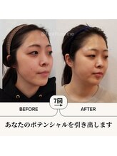 ふらっとエステ/LEE小顔コルギ