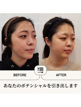 ふらっとエステ/LEE小顔コルギ
