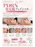 究極の発光肌に・・・PDRN+ピーリングで毛穴レスな艶肌に¥13650→¥9240