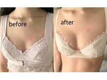 ブレスト 新宿本店(Breast)/《4回目》30代（バストアップ）