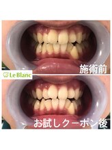 ルブラン 奈良店(Le Blanc)/男性の方も！！
