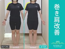美骨矯正 ステキプロ(SUTEKI pro)/巻肩・肩こり・骨盤・姿勢改善