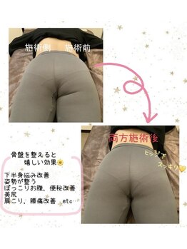 プリマプリート 岐阜店/骨盤ケア